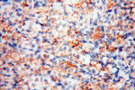 CLCNKA Antibody in Immunohistochemistry (Paraffin) (IHC (P))