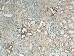 CLCNKA Antibody in Immunohistochemistry (Paraffin) (IHC (P))