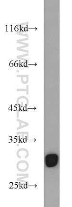 ITM2A Antibody in Western Blot (WB)