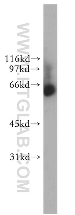 NOP58 Antibody in Western Blot (WB)