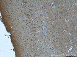 PEG10 Antibody in Immunohistochemistry (Paraffin) (IHC (P))