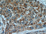 PEG10 Antibody in Immunohistochemistry (Paraffin) (IHC (P))