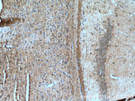 PEG10 Antibody in Immunohistochemistry (Paraffin) (IHC (P))