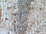PEG10 Antibody in Immunohistochemistry (Paraffin) (IHC (P))