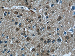 PEG10 Antibody in Immunohistochemistry (Paraffin) (IHC (P))