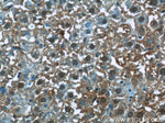 PEG10 Antibody in Immunohistochemistry (Paraffin) (IHC (P))