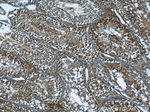 PEG10 Antibody in Immunohistochemistry (Paraffin) (IHC (P))