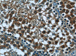 PEG10 Antibody in Immunohistochemistry (Paraffin) (IHC (P))