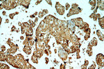 PEG10 Antibody in Immunohistochemistry (Paraffin) (IHC (P))