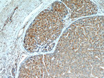 PEG10 Antibody in Immunohistochemistry (Paraffin) (IHC (P))