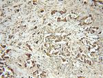 PEG10 Antibody in Immunohistochemistry (Paraffin) (IHC (P))