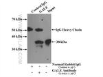 GALE Antibody in Immunoprecipitation (IP)