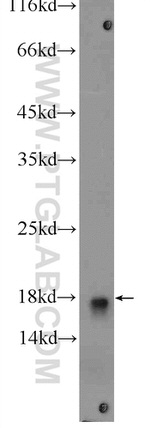 UBE2L3 Antibody in Western Blot (WB)