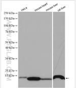 NDUFS6 Antibody in Western Blot (WB)