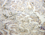 CHSY1 Antibody in Immunohistochemistry (Paraffin) (IHC (P))