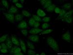 KDM5C Antibody in Immunocytochemistry (ICC/IF)