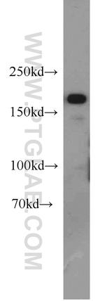 KDM5C Antibody in Western Blot (WB)