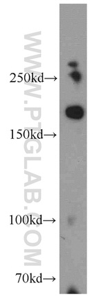 KDM5C Antibody in Western Blot (WB)