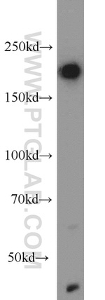KDM5C Antibody in Western Blot (WB)
