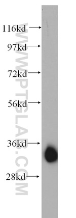 AMPK beta 2 Antibody in Western Blot (WB)