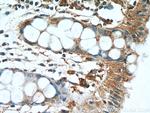 AMPK beta 2 Antibody in Immunohistochemistry (Paraffin) (IHC (P))
