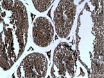 GPX4 Antibody in Immunohistochemistry (Paraffin) (IHC (P))