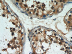 GPX4 Antibody in Immunohistochemistry (Paraffin) (IHC (P))