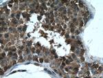 GPX4 Antibody in Immunohistochemistry (Paraffin) (IHC (P))