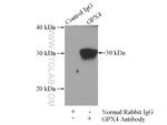 GPX4 Antibody in Immunoprecipitation (IP)