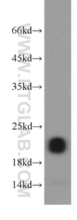 GPX4 Antibody in Western Blot (WB)
