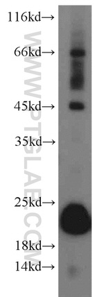GPX4 Antibody in Western Blot (WB)