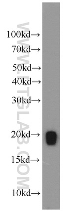 GPX4 Antibody in Western Blot (WB)