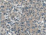 TMPRSS2 Antibody in Immunohistochemistry (Paraffin) (IHC (P))