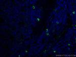 TMPRSS2 Antibody in Immunohistochemistry (PFA fixed) (IHC (PFA))
