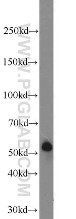 TMPRSS2 Antibody in Western Blot (WB)