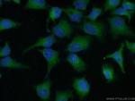 RSK3 Antibody in Immunocytochemistry (ICC/IF)