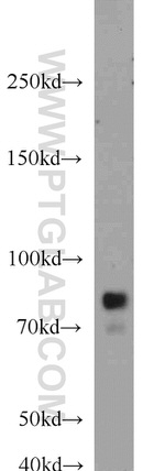 RSK3 Antibody in Western Blot (WB)