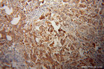 CYP17A1 Antibody in Immunohistochemistry (Paraffin) (IHC (P))