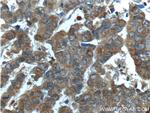 CYP17A1 Antibody in Immunohistochemistry (Paraffin) (IHC (P))
