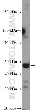 CYP17A1 Antibody in Western Blot (WB)