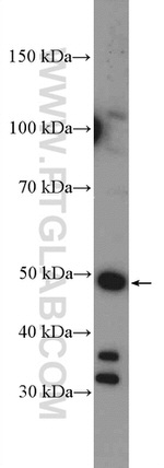 CYP17A1 Antibody in Western Blot (WB)