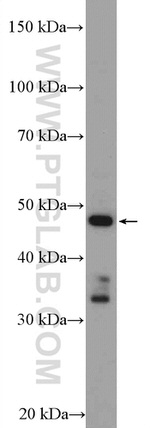 CYP17A1 Antibody in Western Blot (WB)
