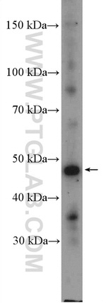 CYP17A1 Antibody in Western Blot (WB)
