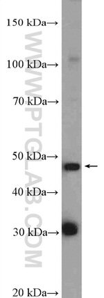 CYP17A1 Antibody in Western Blot (WB)