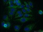 KLHL2 Antibody in Immunocytochemistry (ICC/IF)