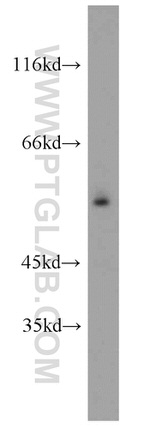 PLVAP Antibody in Western Blot (WB)