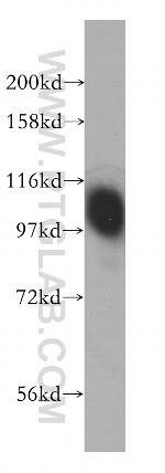B7-H3 Antibody in Western Blot (WB)