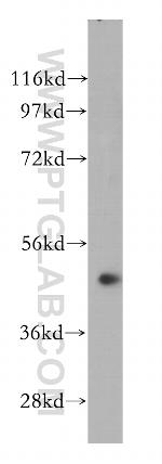 NOB1 Antibody in Western Blot (WB)