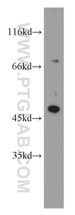 NOB1 Antibody in Western Blot (WB)