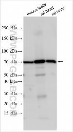 UGT1A10 Antibody in Western Blot (WB)